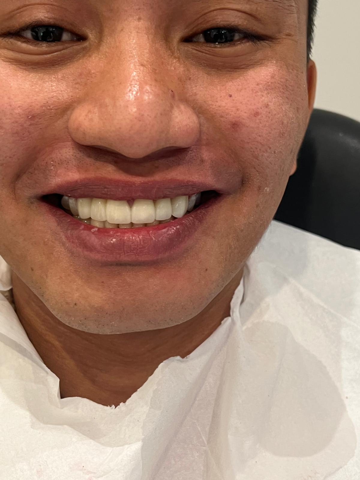 ECE Dental Patient Transformation